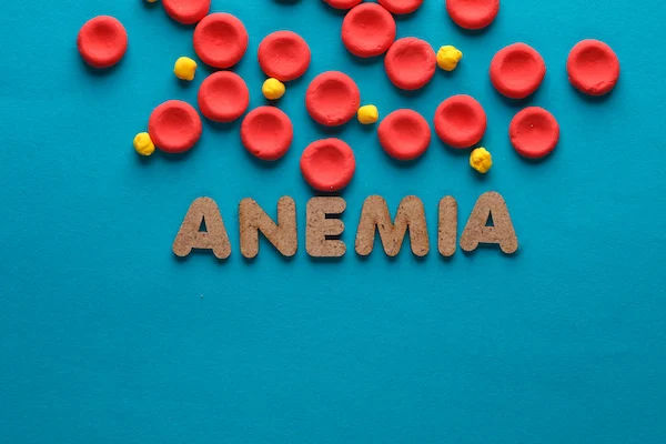 anemia